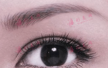 激光洗眉紅痕多久能淡化？如何護(hù)理激光洗眉后的紅?。?></a><p class=