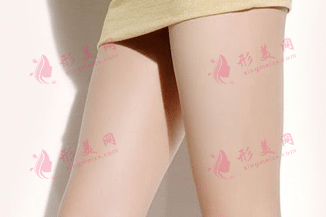 大腿吸脂 大腿吸脂