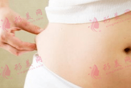 剖腹產(chǎn)后的腰間贅肉 剖腹產(chǎn)后的腰間贅肉