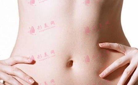 腰腹吸脂 腰腹吸脂