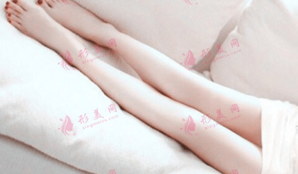 小腿吸脂 小腿吸脂