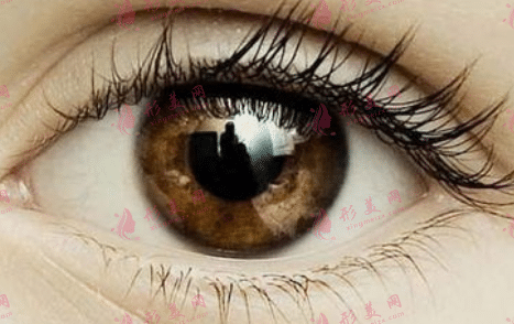 開(kāi)內(nèi)眼角 開(kāi)內(nèi)眼角