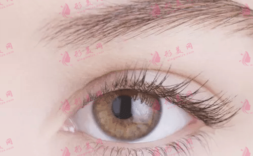 雙眼皮 雙眼皮