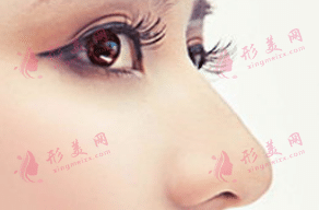 假體隆鼻 假體隆鼻