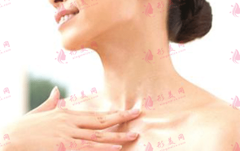 去除頸紋 去除頸紋