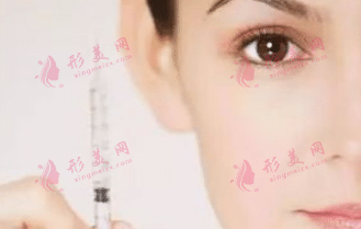注射肉毒素 注射肉毒素