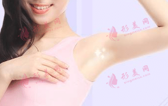 激光脫腋毛 激光脫腋毛