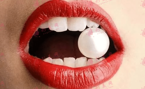 冷光美白 冷光美白