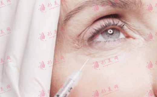 皺紋 皺紋