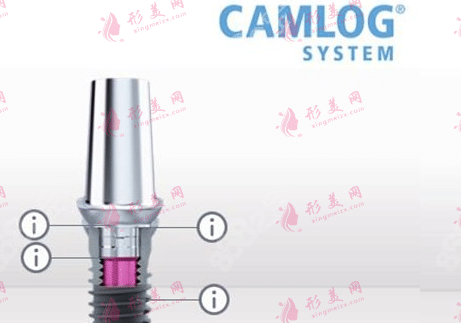 Camlog種植體 Camlog種植體
