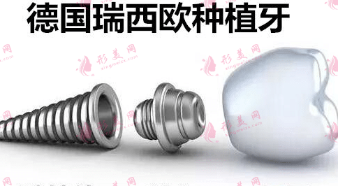 德國(guó)ht瑞西歐種植體 德國(guó)ht瑞西歐種植體