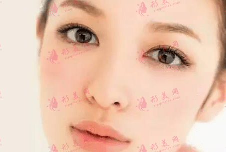 自體脂肪豐臉頰 自體脂肪豐臉頰