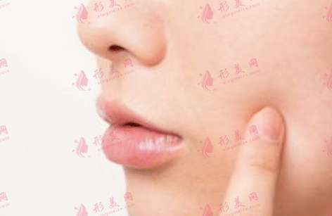 自體脂肪移植 自體脂肪移植