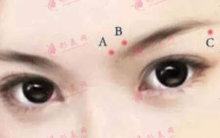 切眉后多久可以紋眉？術(shù)后應(yīng)該怎么護(hù)理？