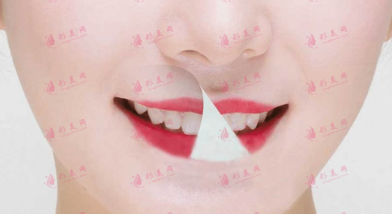 口腔治療 口腔治療