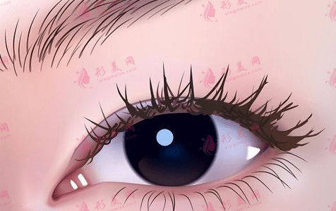 開眼角 開眼角