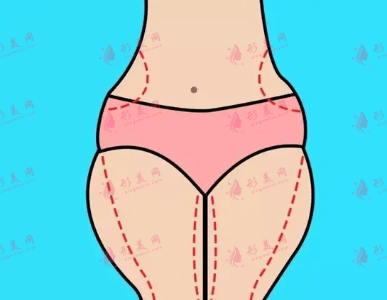 上海九院吸脂價格