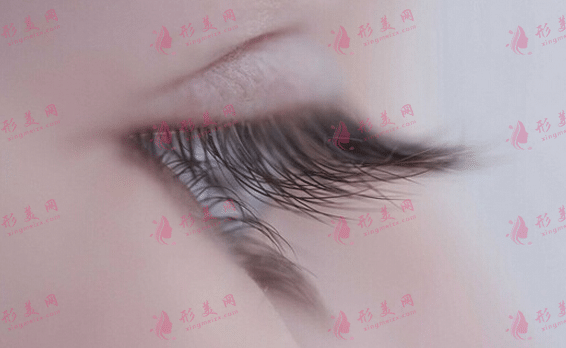 孕睫術(shù) 孕睫術(shù)