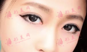 美瞳線 美瞳線