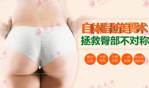 自體脂肪豐臀 自體脂肪豐臀
