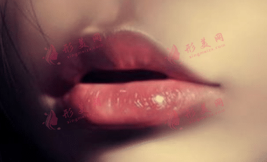 嘴巴凸起的原因有哪些？面部填充改善面部凹陷效果如何？