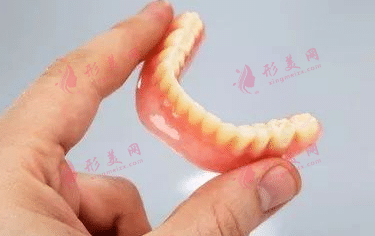 活動(dòng)假牙 活動(dòng)假牙