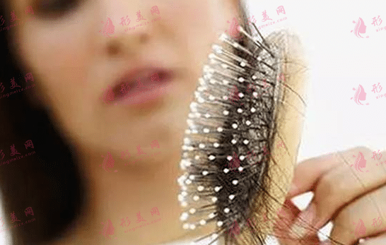 瘋狂脫發(fā) 瘋狂脫發(fā)