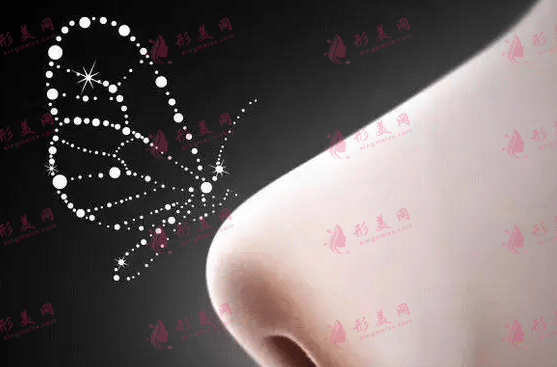 膨體隆鼻 膨體隆鼻