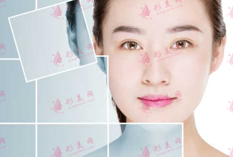 整形手術(shù) 整形手術(shù)