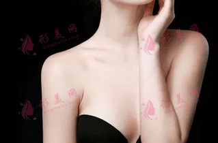 自體脂肪隆胸 自體脂肪隆胸