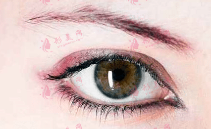 開內(nèi)眼角 開內(nèi)眼角