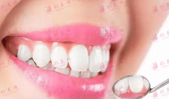 牙齒矯正 牙齒矯正