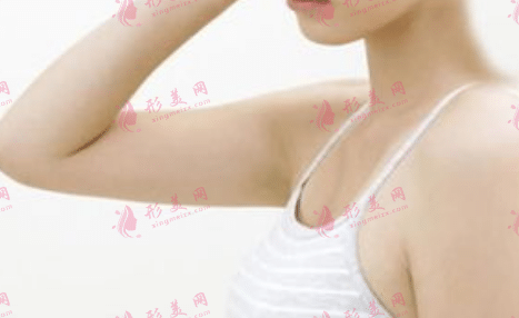 冰點脫毛 冰點脫毛