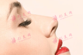 假體隆鼻