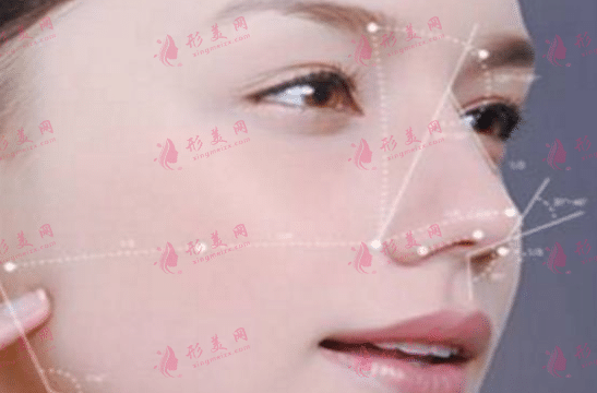 鼻修復(fù) 鼻修復(fù)