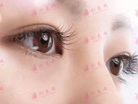 上海九院哪個(gè)醫(yī)生做雙眼皮和雙眼皮修復(fù)比較好？