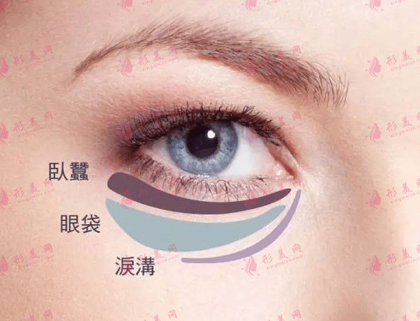溶脂去眼袋手術多少錢?激光溶脂去眼袋果好嗎?
