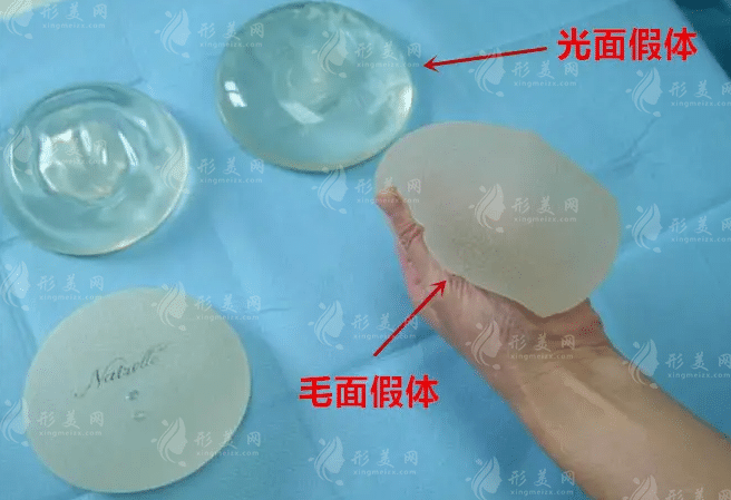 內(nèi)窺鏡豐胸手術(shù)恢復(fù)期長不長? 內(nèi)窺鏡豐胸手術(shù)恢復(fù)期長不長?