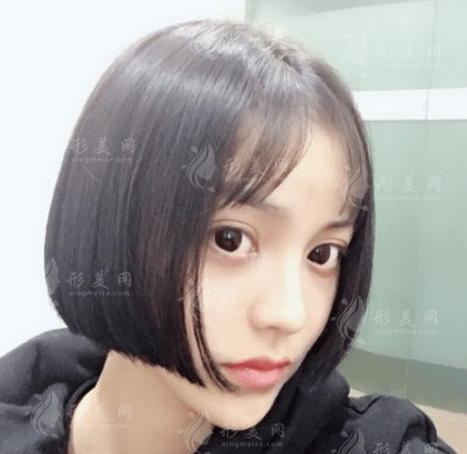 長(zhǎng)春韓尚植發(fā)醫(yī)院怎么樣？2022發(fā)際線種植案例展示