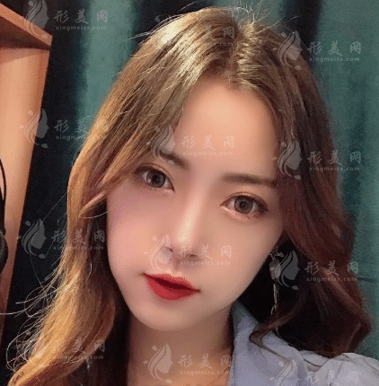 武漢協(xié)和醫(yī)院整形科做雙眼皮怎么樣？醫(yī)院實力及案例一覽