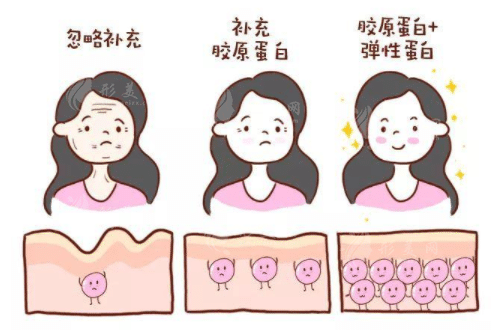膠原蛋白怎么補？外涂、注射、口服？哪種方式最有用？