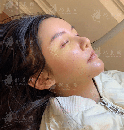 杭州李保鍇修復(fù)鼻子怎么樣？醫(yī)生簡介+鼻修復(fù)案例鑒賞