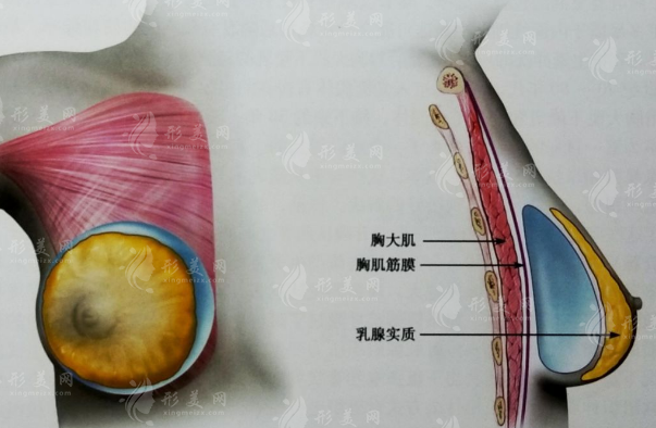 北京協(xié)和曾昂假體隆胸特色項目