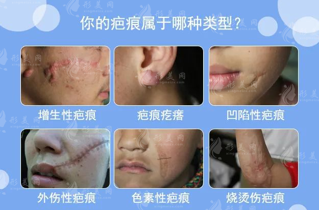 武漢正璞醫(yī)療美容做修復(fù)疤痕技術(shù)好不好？