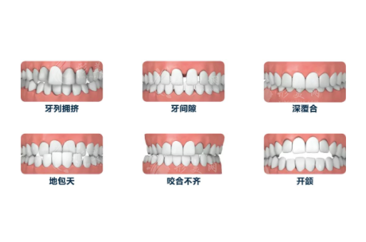牙齒矯正