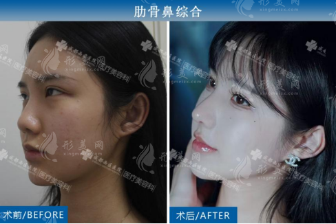 網(wǎng)紅程小雨