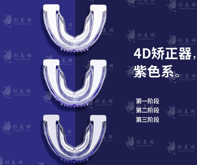 地包天牙齒矯正器要戴多久？