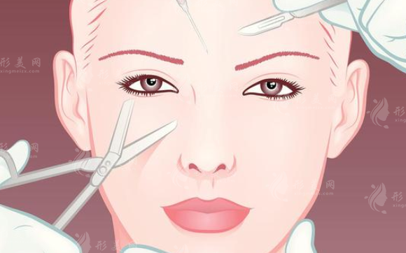 沈陽杏林整形醫(yī)院隆鼻怎么樣？實(shí)力派醫(yī)生介紹+整形價(jià)格表