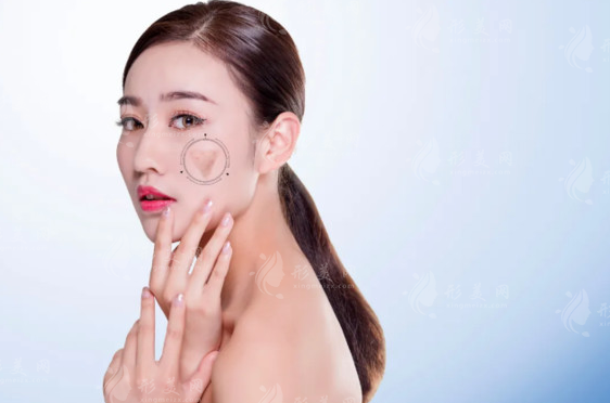 面部吸脂效果怎么樣？面部吸脂適用于所有人嗎？