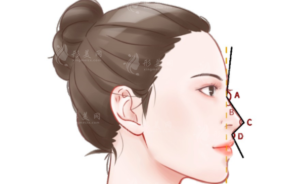 肋骨鼻修復(fù)原來鼻子中的肋骨可以二次用嗎？